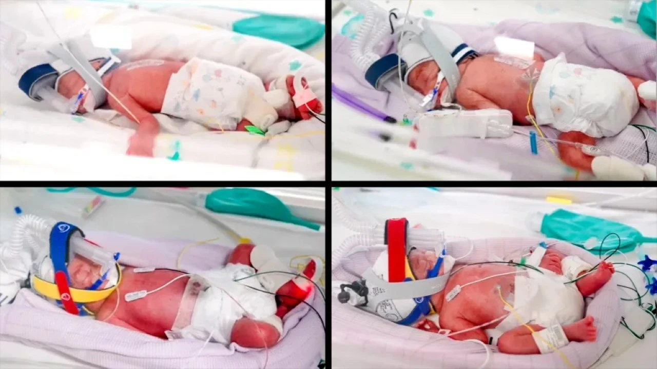Doktorlar şaşırdı: 15 milyonda bir görülüyor