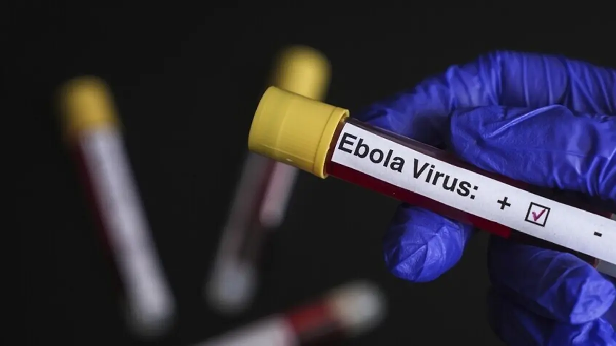 İsrail'de Ebola alarmı! Karantinaya alındı