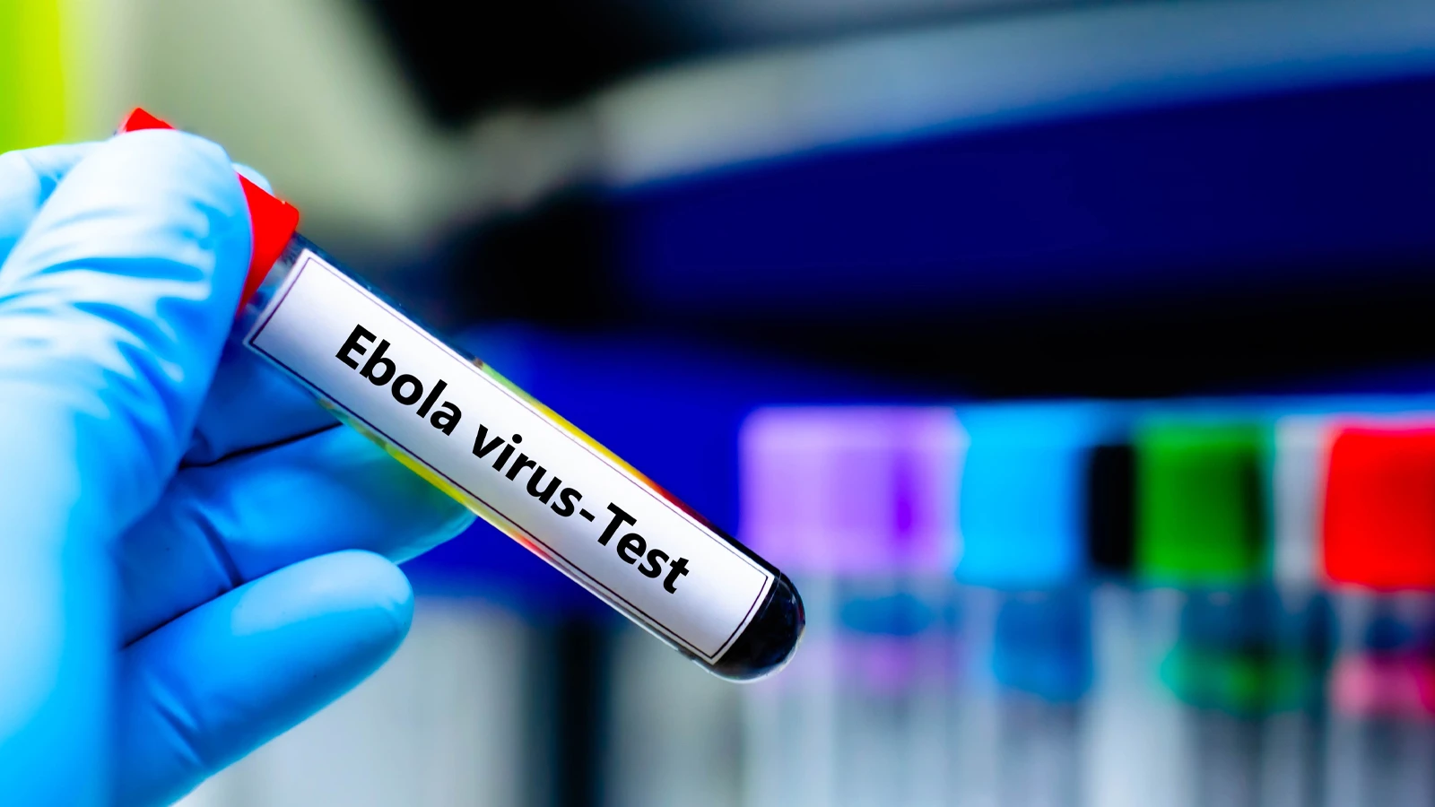 İsrail'de ilk kez Ebola şüphesiyle bir kişi karantinaya alındı