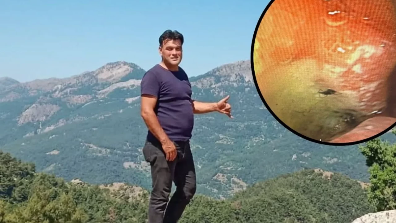 Midesinde böcek çıktı: Yaylada uyurken yaşadığı olay tıbbi literatüre girdi!