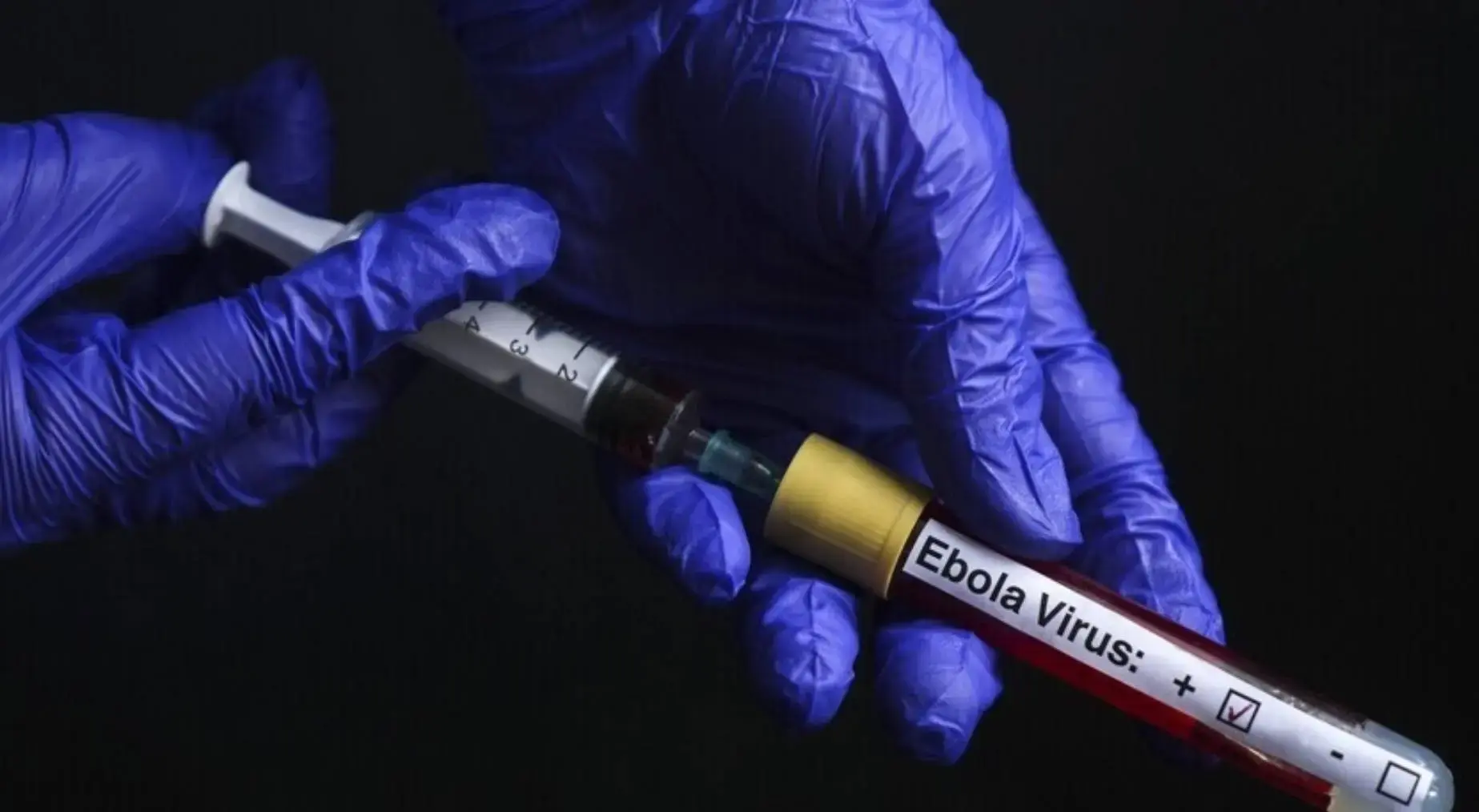 Fransa’da Ebola alarmı! 21 günlük karantina süreci başladı