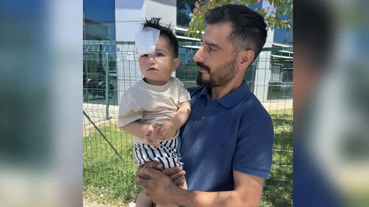 Halfeti'deki köpek saldırısında Bakanlık devrede! Müfettiş görevlendirildi