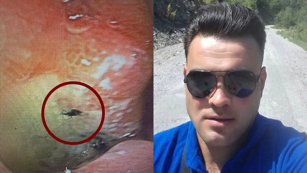 Mide ağrısı şikayetiyle gitti, karnından çıkan şoke etti!