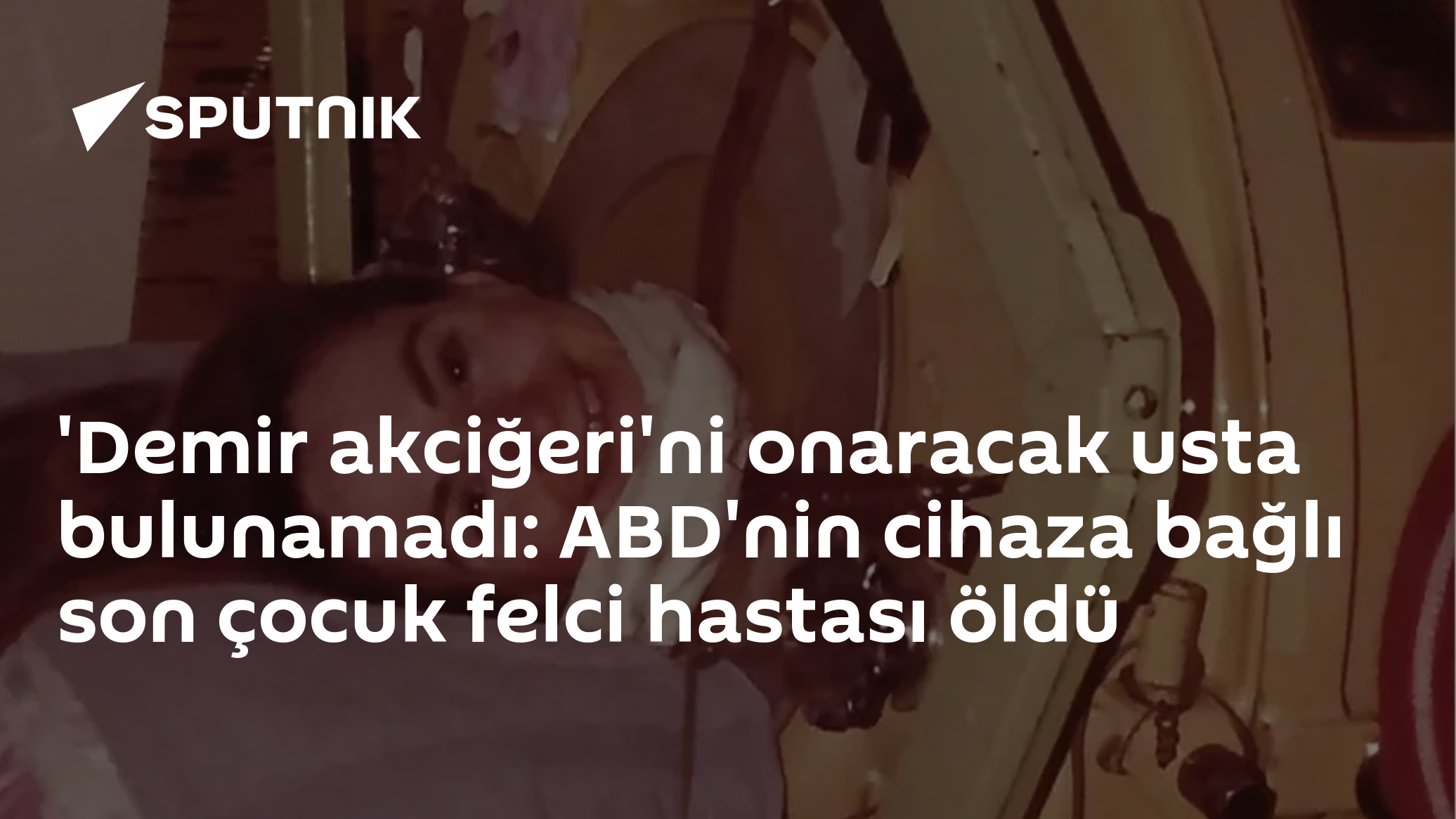 'Demir akciğeri'ni onaracak usta bulunamadı: ABD'nin cihaza bağlı son çocuk felci hastası öldü