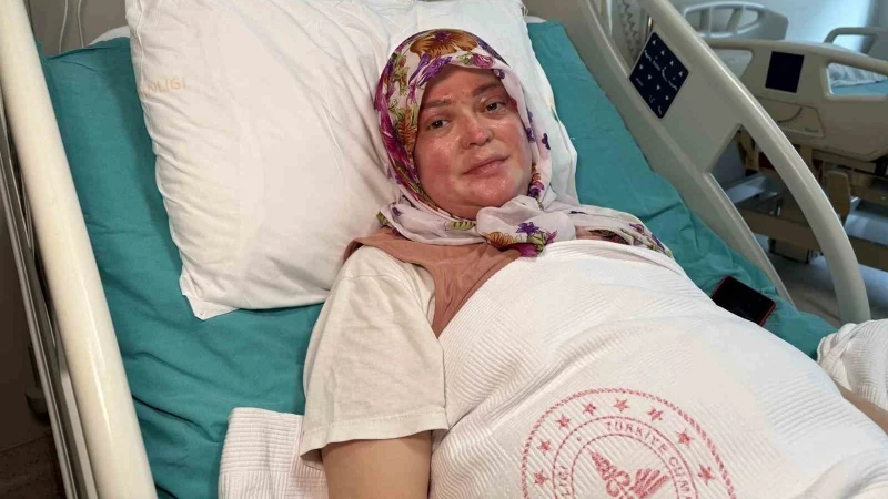 Vücudunun yüzde 70’i yandı: Karadeniz turu yapacaktık alev topuna döndüm