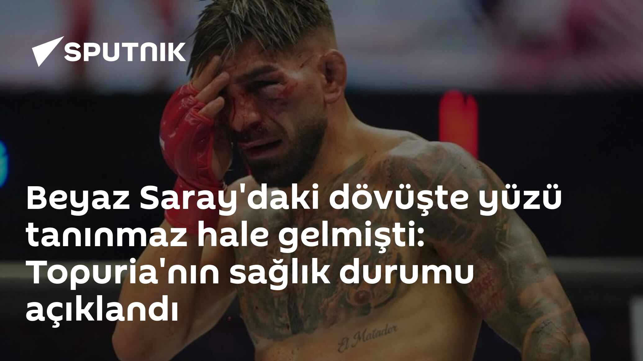 Beyaz Saray'daki dövüşte yüzü tanınmaz hale gelmişti: Topuria'nın sağlık durumu açıklandı