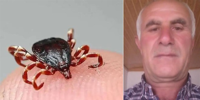 Keneyi kendi çıkardı, dört gün sonra öldü