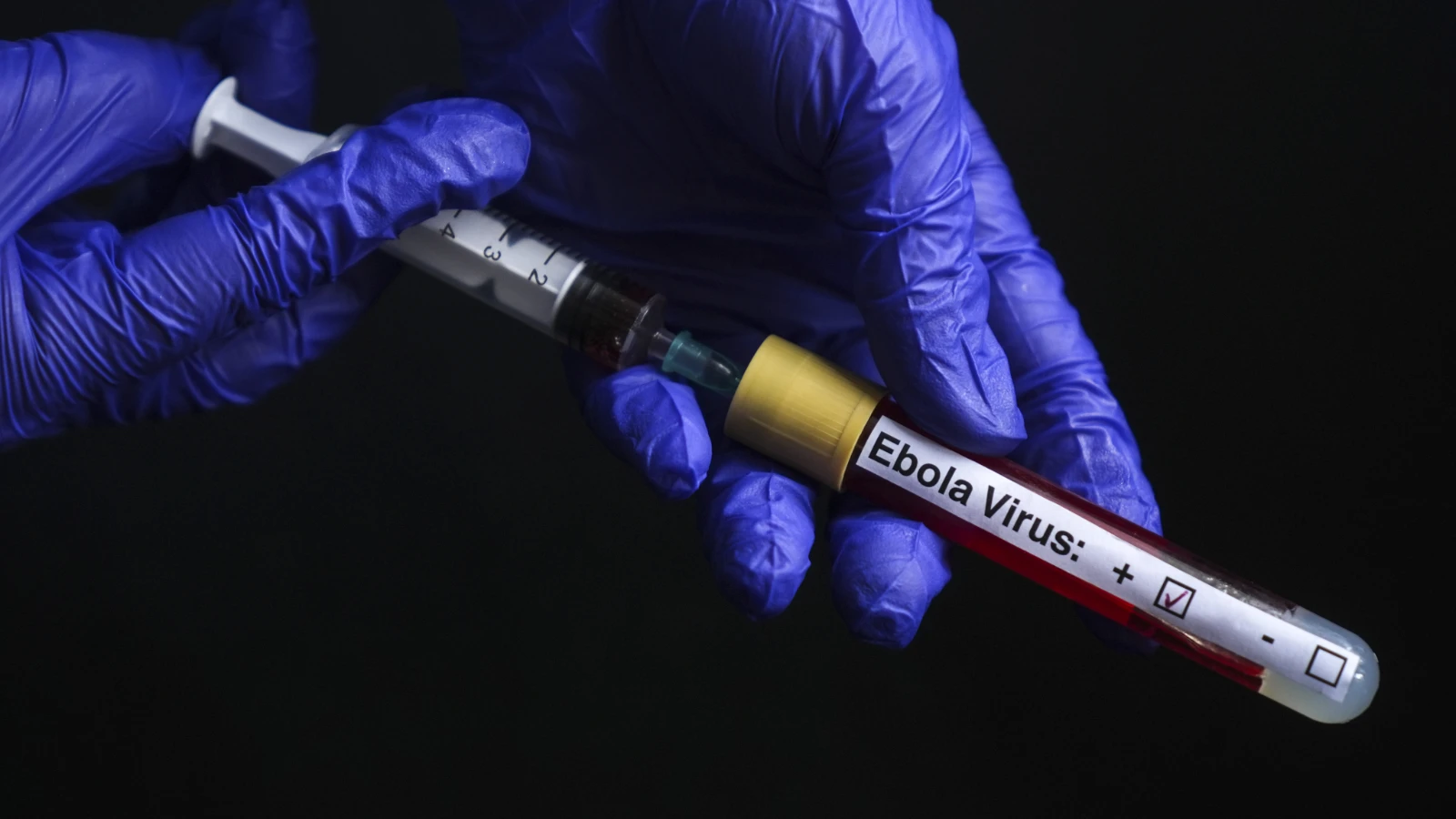 Ölümcül Ebola alarmı büyüyor! Avrupa'ya sıçramıştı: Vaka sayısı 1.223'e, can kaybı 323'e yükseldi