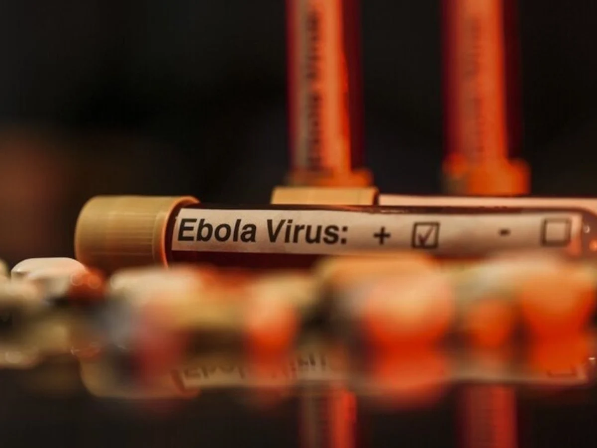 Kenya, ABD'nin ebola karantina tesisi kurmasına izin verdi
