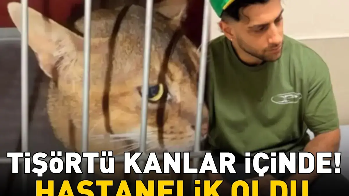 REYNMEN HASTANELİK OLDU! Kedisinin Saldırısına Uğrayan Ünlü Şarkıcının Tişörtü Kanlar İçinde Kaldı