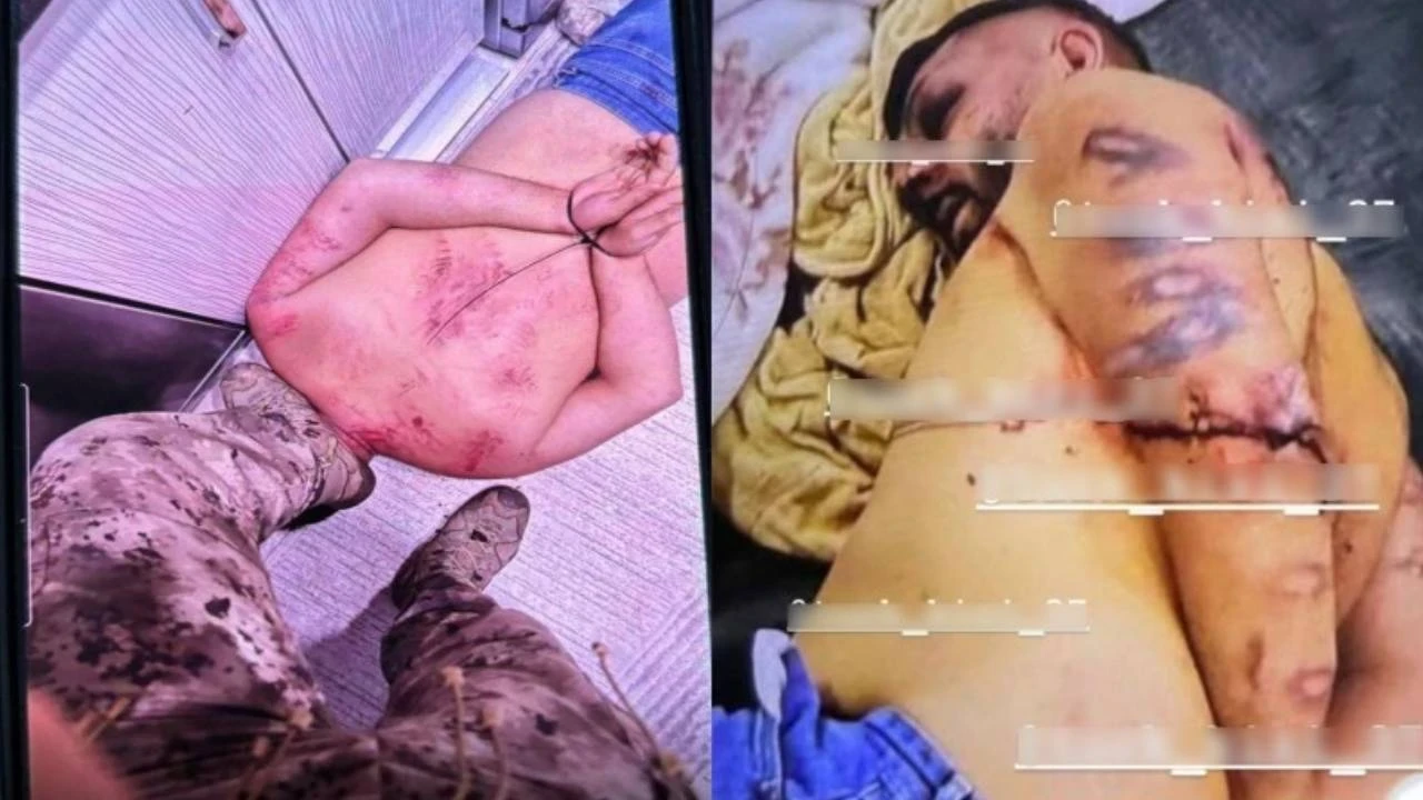 Polis baskınındaki işkencenin fotoğrafları ortaya çıktı