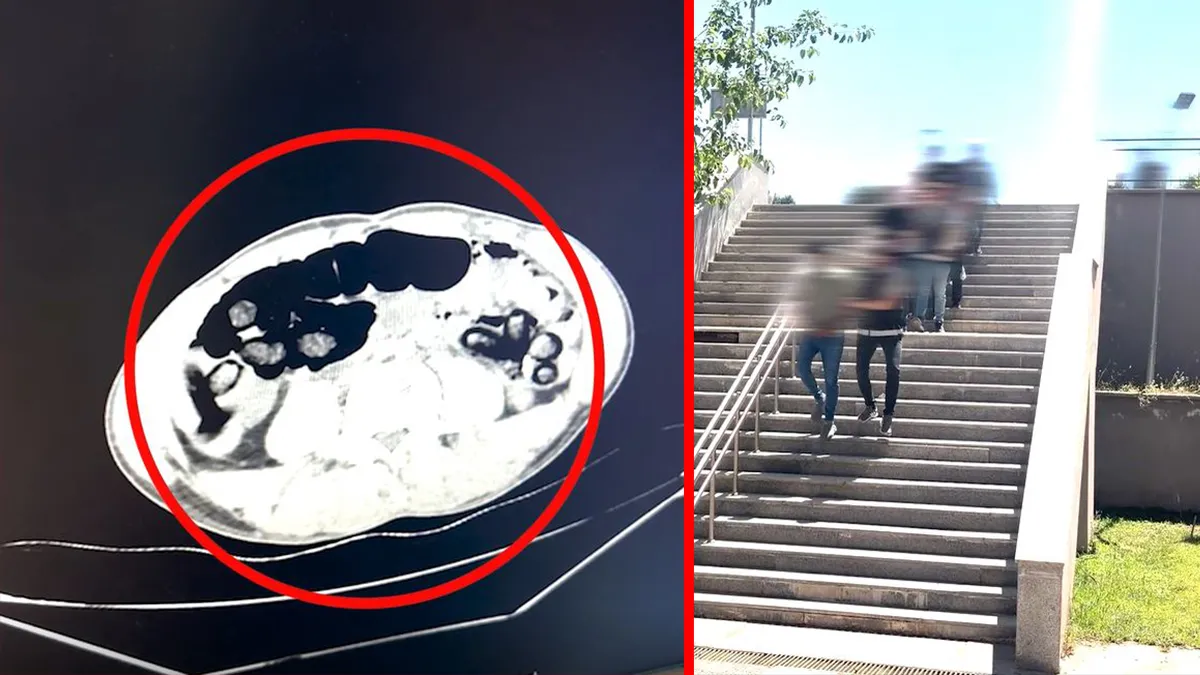 Batman’da akılalmaz olay! Midelerini uyuşturucu deposuna çevirmişler: 4 yolcudan tam 353 parça…