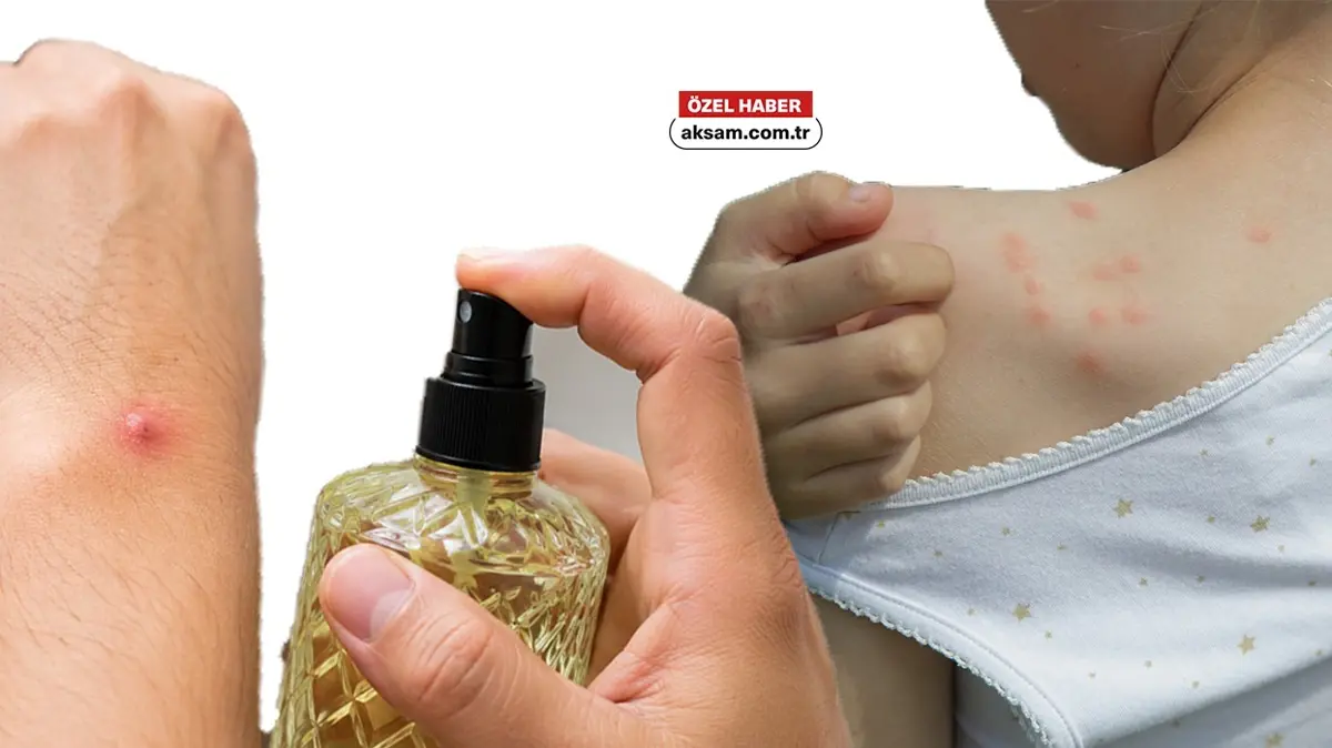 Isırıklara kolonya dökmeyin! Uzmanı böcek ve pire ısırıklarını ayırt etmenin tek yöntemini açıkladı