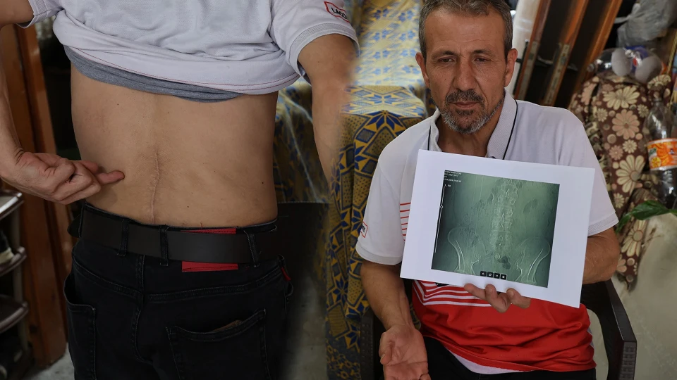 Platinleri sökerken öyle bir şey unuttu ki: 2 çocuk babası adam eve hapsoldu | ADANA YEREL HABERLERİ