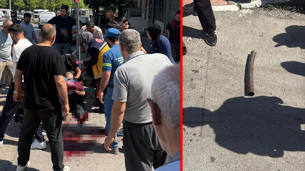 Bursa’da esnaf kavgası kanlı bitti! Yaralı babanın feryadı yürek dağladı: Oğlum sakın ölme!