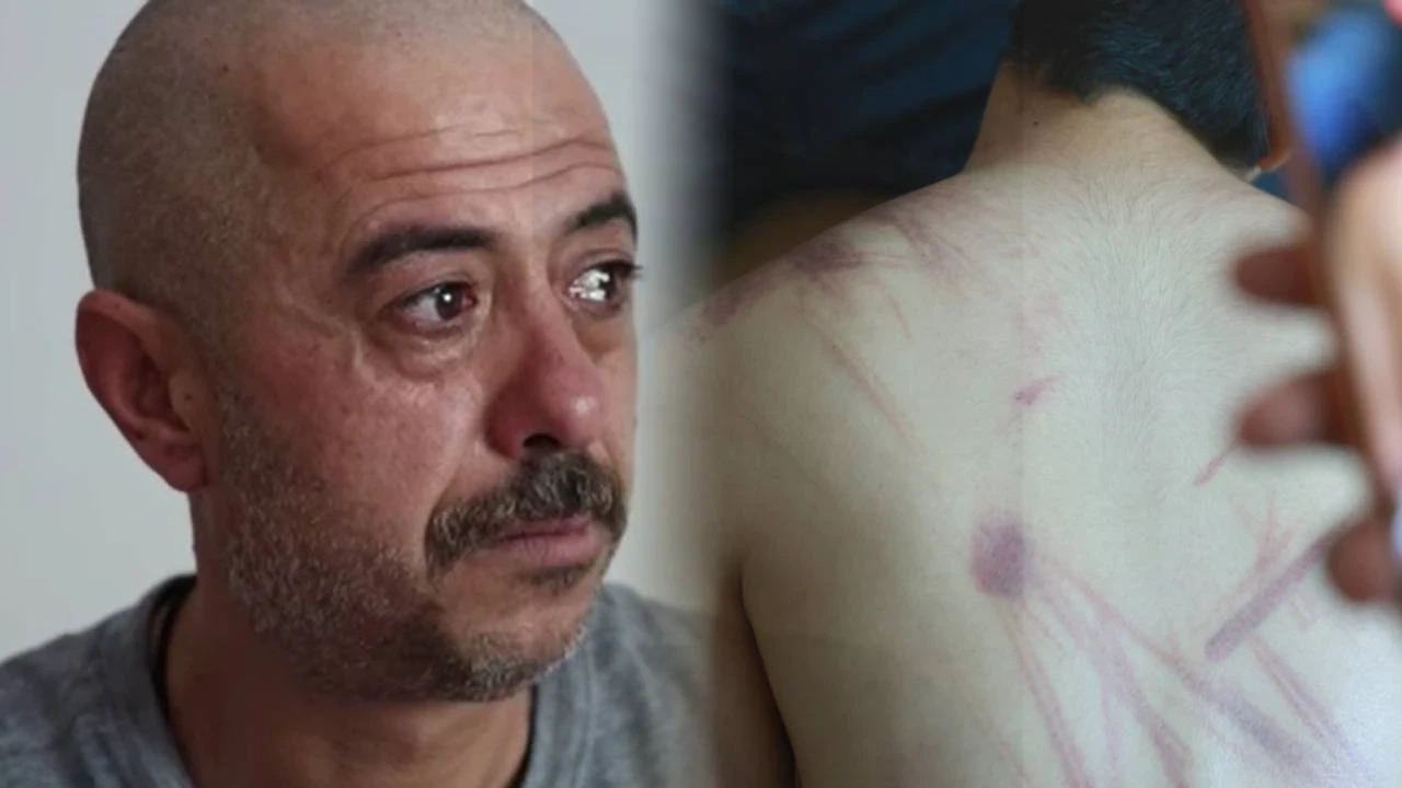 Özel Eğitim Merkezi’nde kan donduran olay: 14 yaşındaki engelli çocuğa şiddet