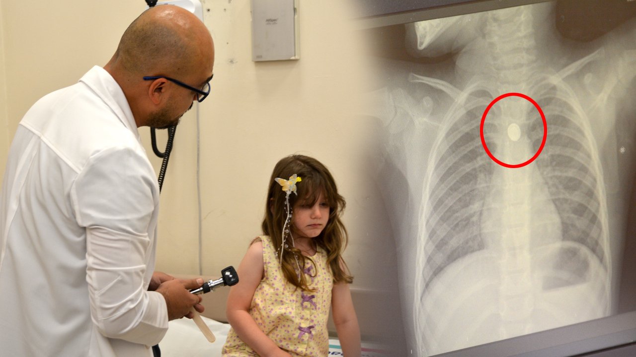 Saat pili yutan çocuğa tam zamanında müdahale! Doktor, aileleri uyardı
