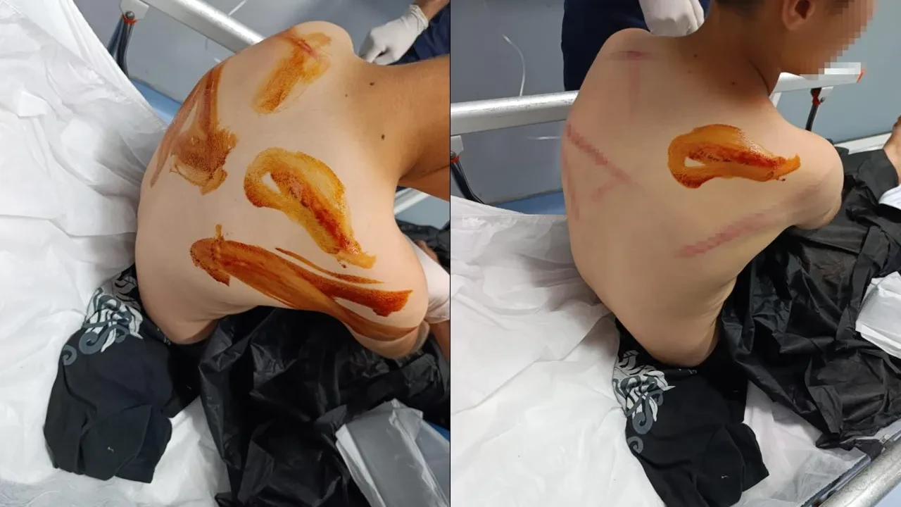 Şanlıurfa'da feci olay! 11 yaşındaki çocuk sopayla öldüresiye darbedildi