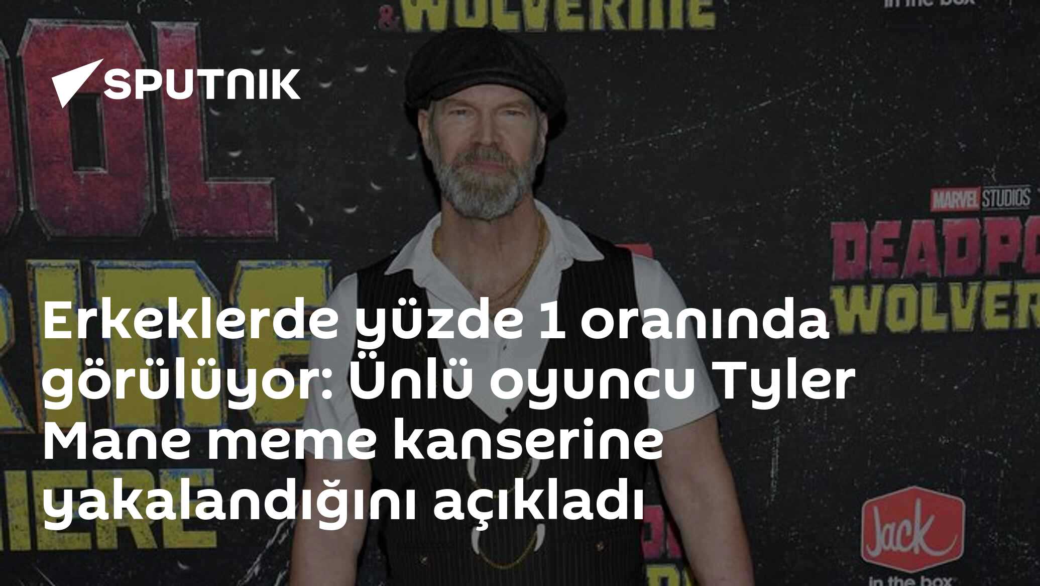 Erkeklerde yüzde 1 oranında görülüyor: Ünlü oyuncu Tyler Mane meme kanserine yakalandığını açıkladı