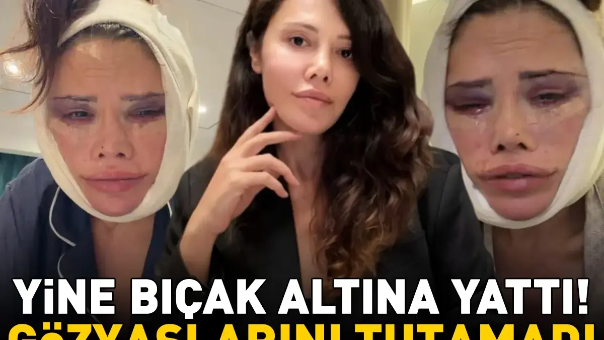 Yüz nakli olan Survivor Didem Ceran, bir kez daha bıçak altına yattı! Gözyaşlarını tutamadı