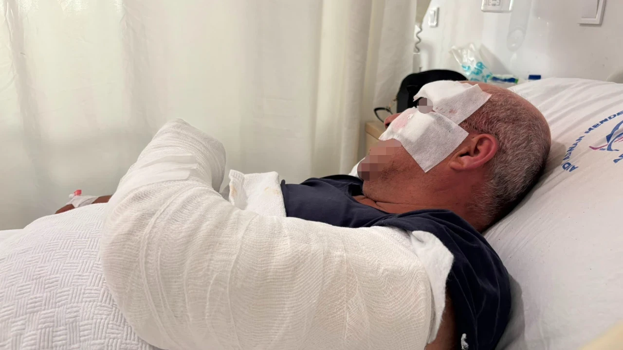 Motosikletten düşen sürücüden şok iddia: “Kardeşim bilerek çarptı”