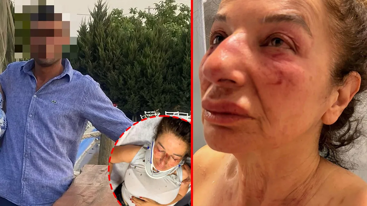 İzmir’de korkunç olay! Hayvanlara yardım bahanesiyle çağırıp kemerle boğmaya çalıştı: ‘Hayatta kalmam şans’