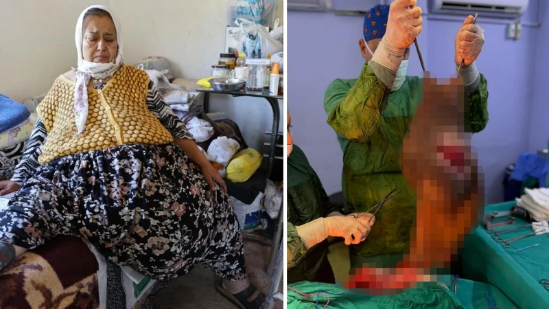 Bağ evinde yaşayan kadım 170 kiloya ulaştı: Karnında 40 kiloluk kitle varmış