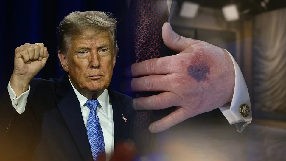 Trump Walter Reed'de sağlık kontrolünden geçti: Tam puan aldım