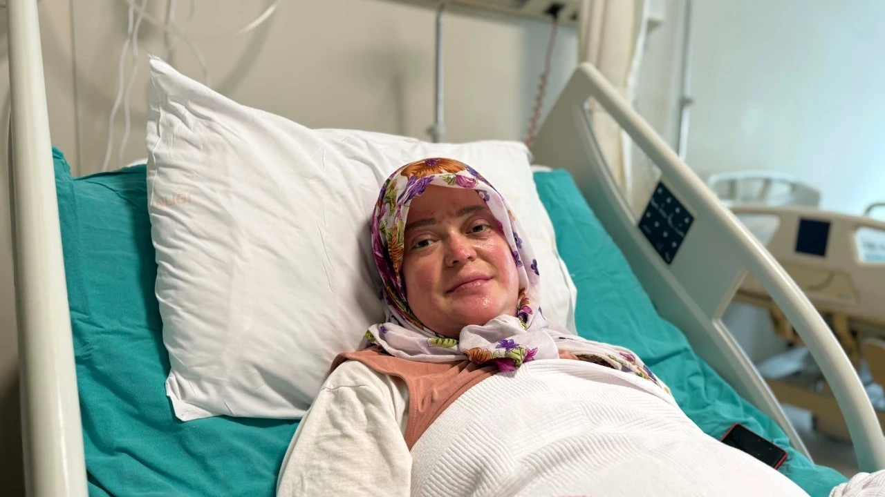 Çakmağı yaktı, karavan patladı! 16 gün uyutuldu: Alev topuna döndüm! 'Anne yanıyoruz...'