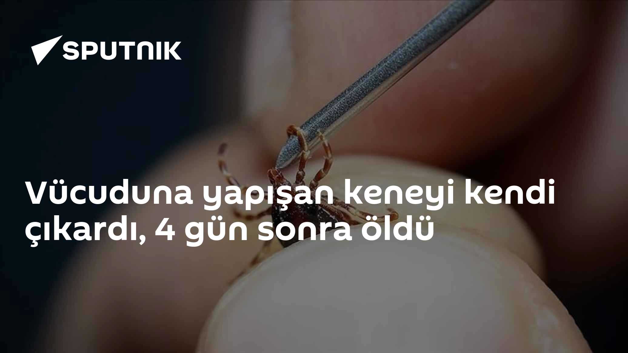 Vücuduna yapışan keneyi kendi çıkardı, 4 gün sonra öldü
