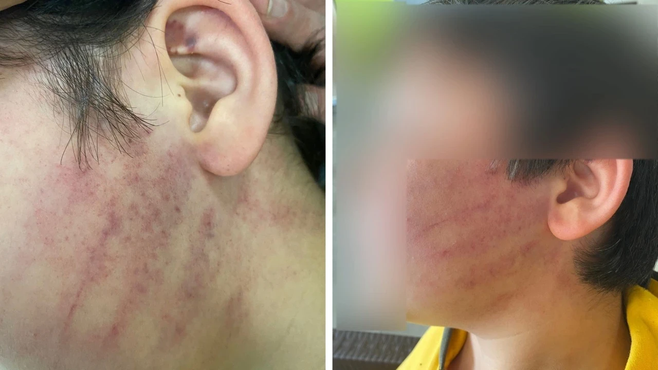 Öğrenciye şiddette fırça silah sayıldı