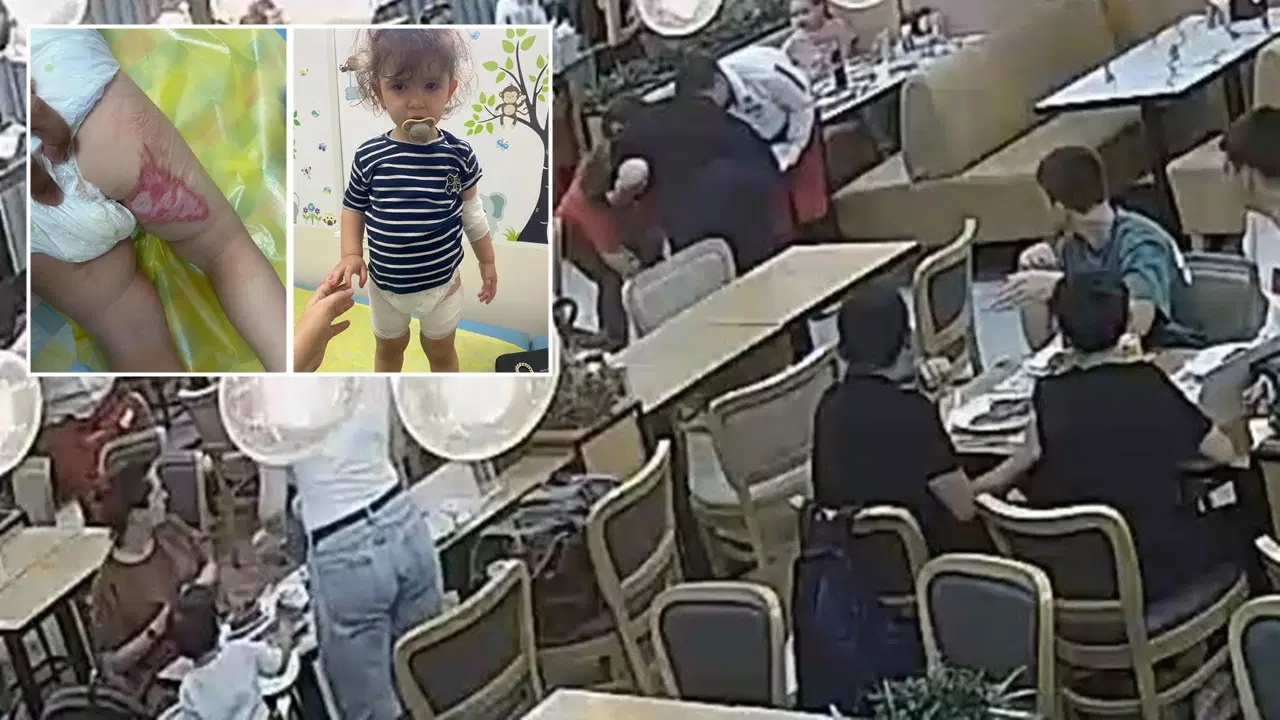 Restorandaki ’tereyağı şovu’ 2 yaşındaki Mercan'ı yaktı, mahkemenin verdiği ceza aileyi isyan ettirdi