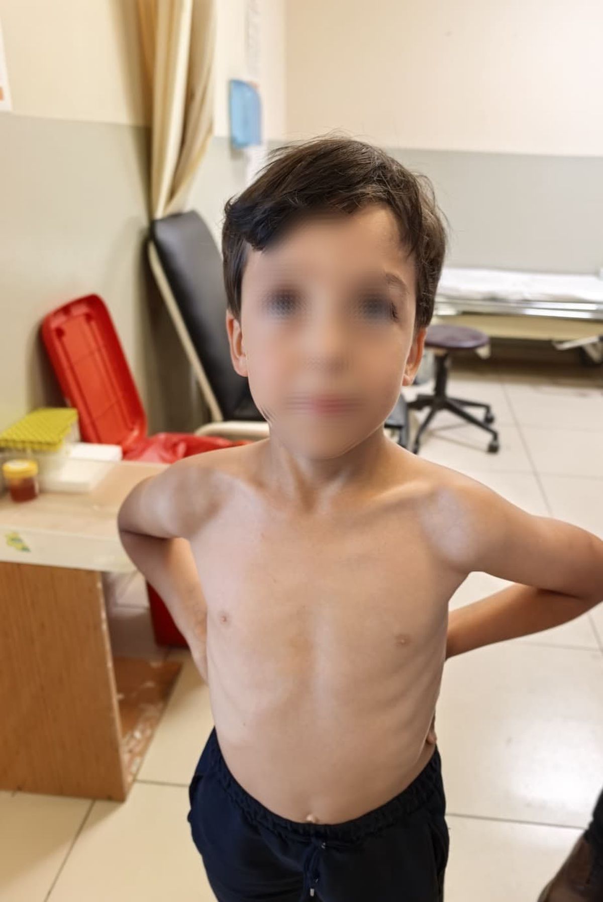 7 yaşındaki Mustafa'nın göğsüne kene yapıştı