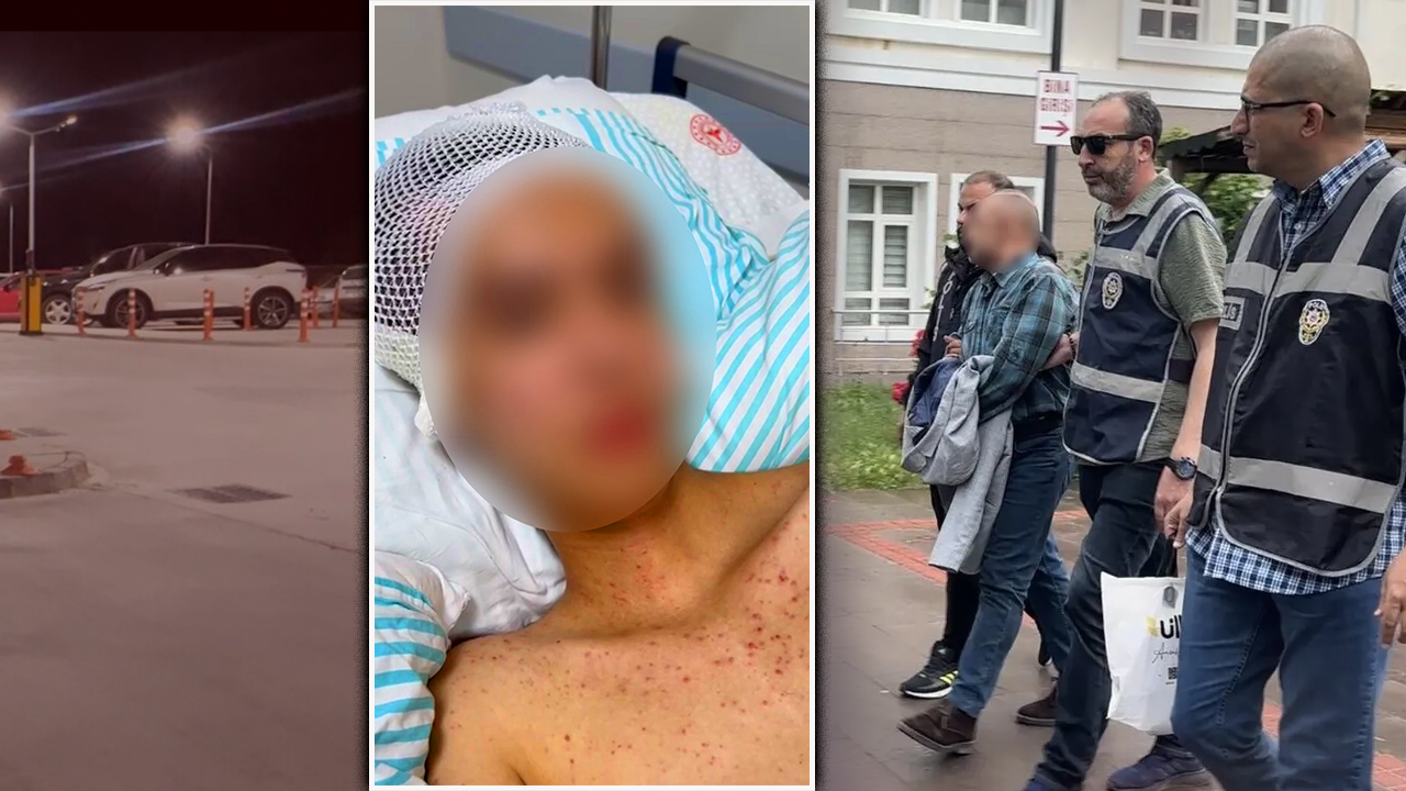 Korkunç ‘taciz’ iddiasında kahreden olay! Başından vurulan çocuk felç kaldı