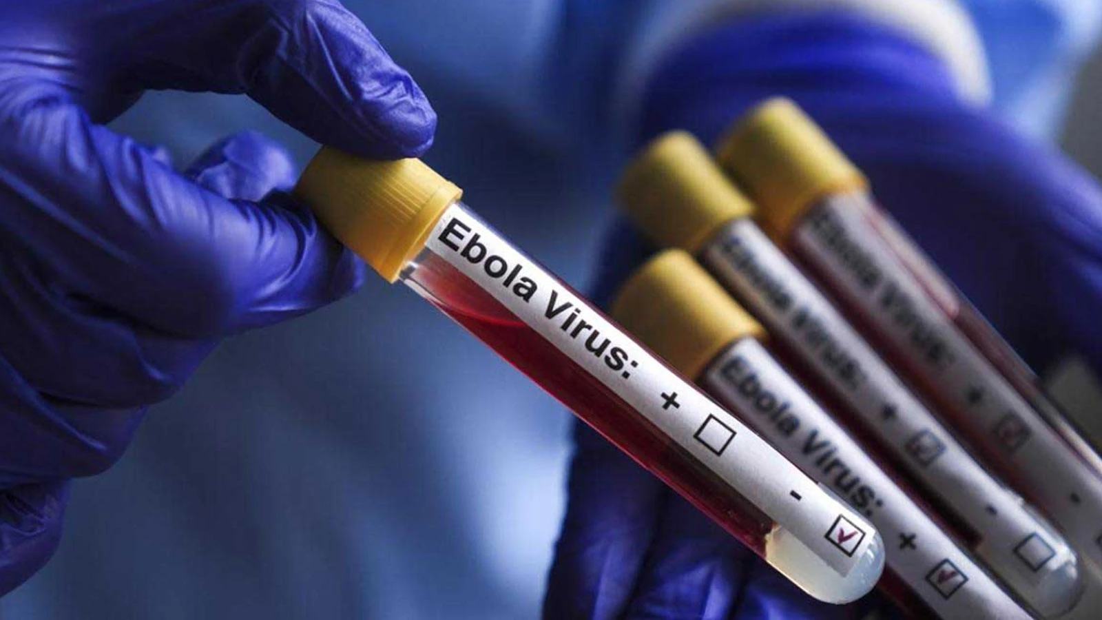 BM'den Ebola uyarısı!