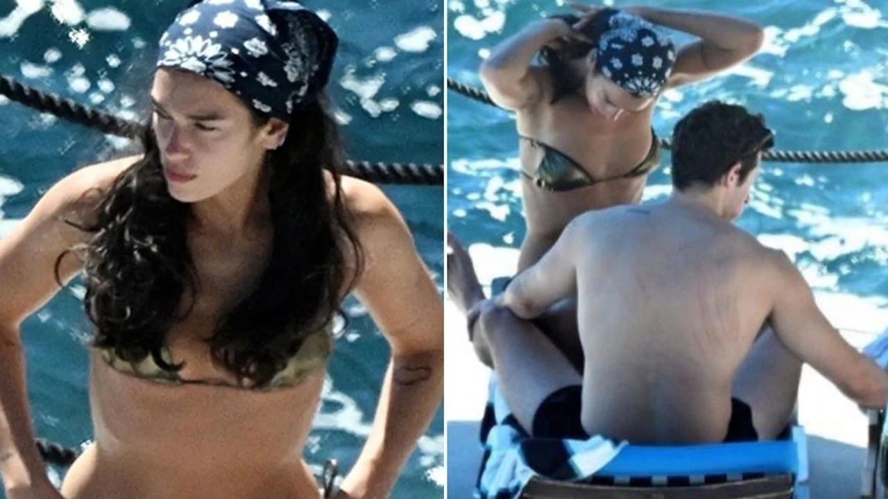 Dua Lipa'nın eşi Callum Turner'ın sırtındaki çizikler sosyal medyada gündem oldu