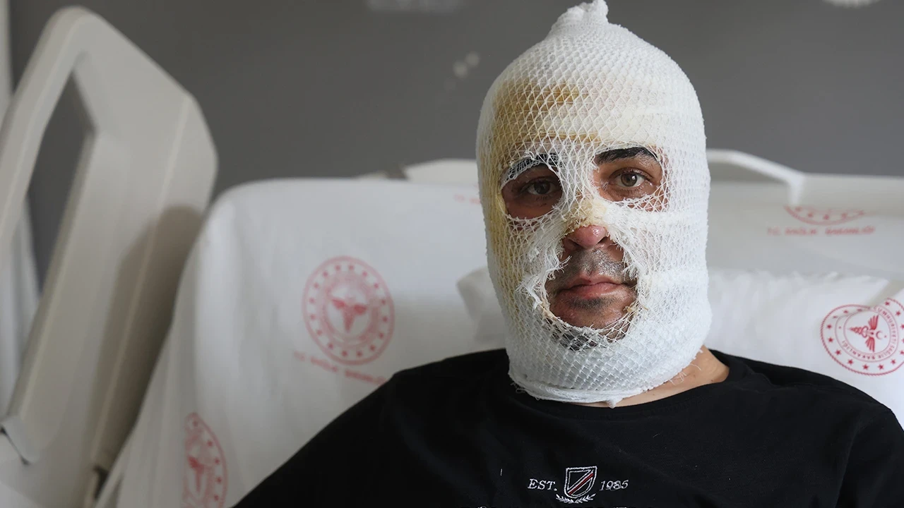 Hatay'da korkutan konteyner yangını: Tostçu esnafı alevlerin arasında kaldı