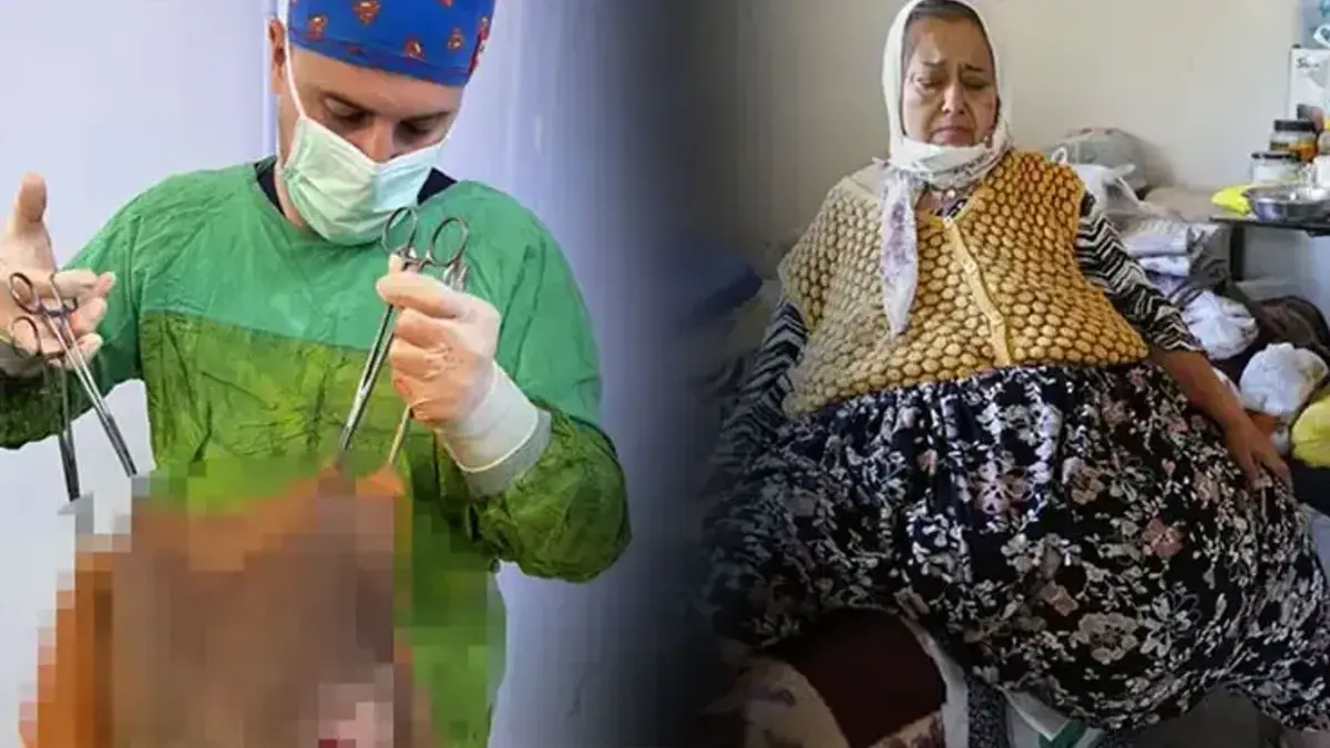 67 yaşındaki kadının karnından tam 40 kilogram kitle çıktı
