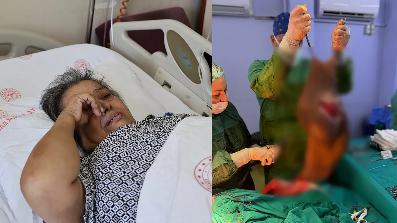 Karnından bir insan büyüklüğünde kitle çıkarıldı: Ameliyathaneden 40 kilo daha zayıf çıktı