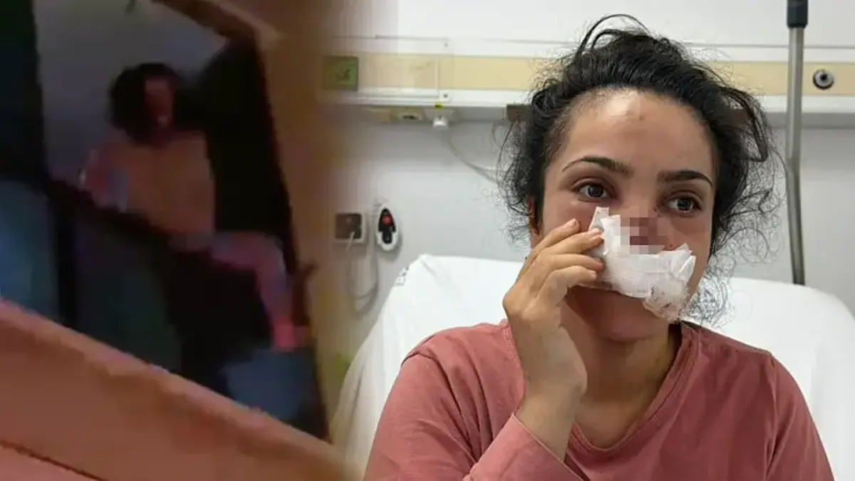 Kocası tarafından burnu ısırılıp koparılan İmran konuştu: Balkondan atlamayı düşündüm