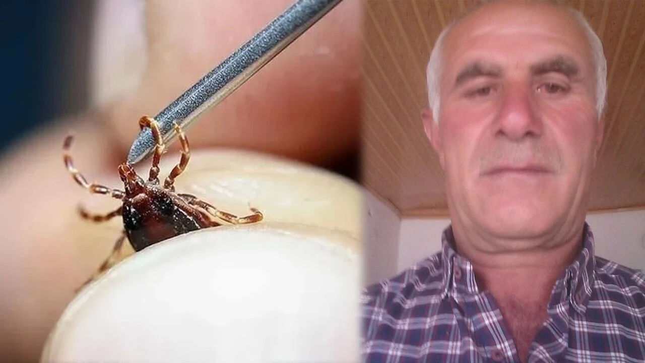 Kendi imkanlarıyla keneyi çıkardı: 4 gün sonra öldü