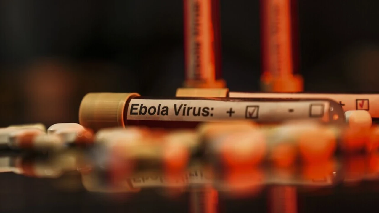 DSÖ: Uganda'da şimdiye kadar 19 Ebola virüsü vakasının görüldü