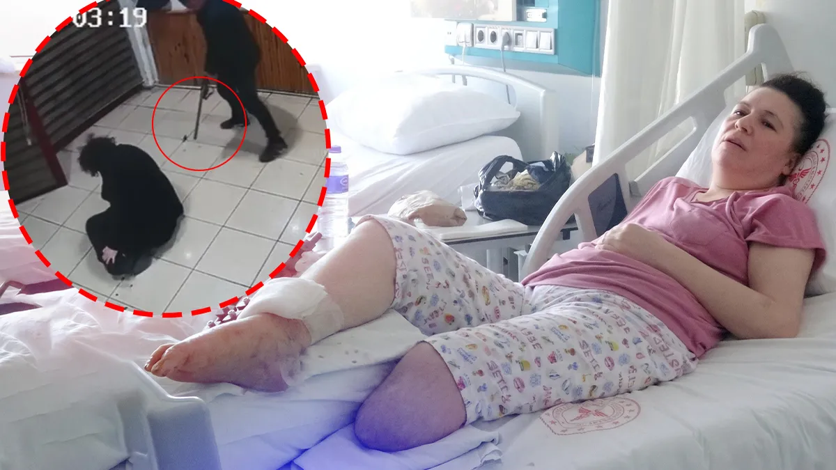 Boşanma aşamasındaki eşine kurşun yağdırdı! Bacağını kaybeden talihsiz kadın kabus dakikalarını anlattı: ‘Ben sensiz yaşayamam’ deyip…