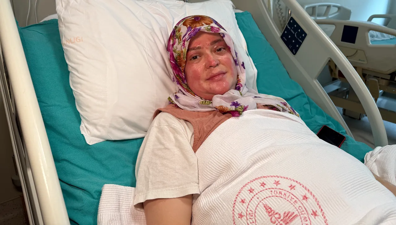 Karavandaki bir hata faciaya dönüştü! Vücudunun yüzde 70'i yandı