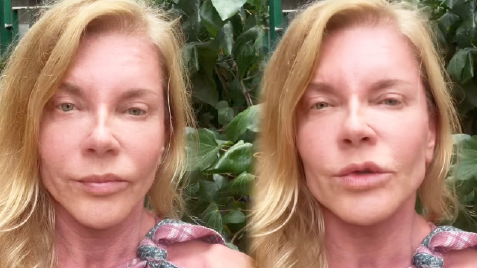 Biricik Suden'den estetik iddialarına sert yanıt
