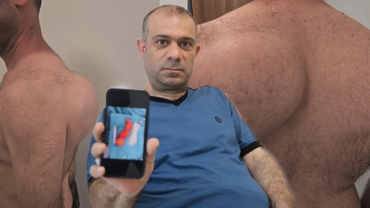 Başta önemsemedi, sırtındaki şişlik devasa boyuta ulaştı! 22 yıllık doktoru şaşkına çeviren olay