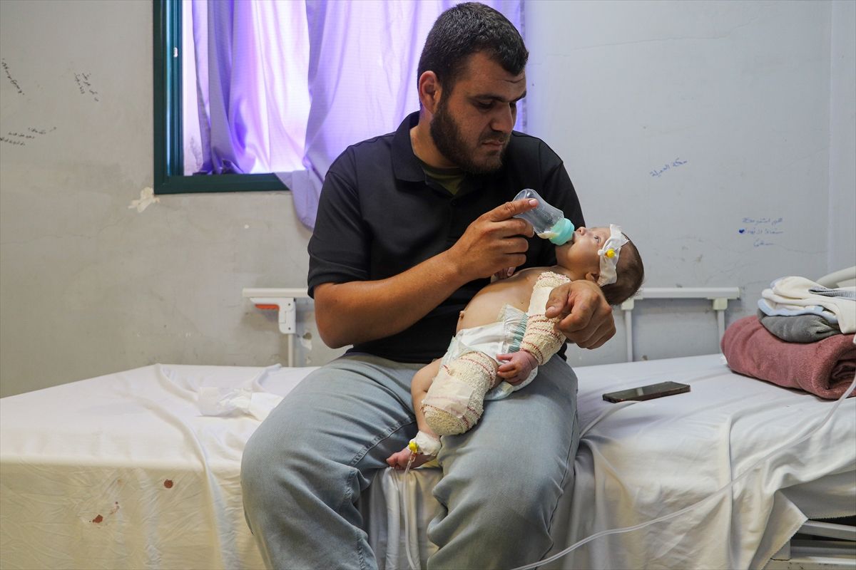 50 günlük bebek İsrail saldırısında annesini kaybetti, bacağı ampute edildi
