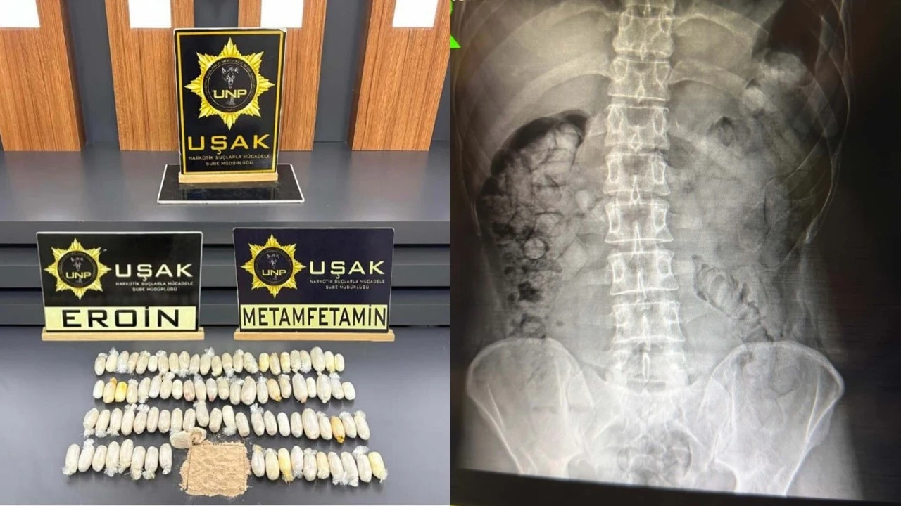 Midelerinden uyuşturucu çıktı: İran uyruklu 2 zanlı tutuklandı