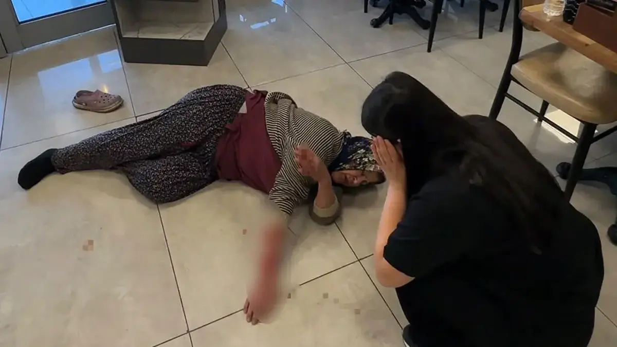 Dinlenme tesisinde dehşet! Sahipsiz köpek kolunu kopardı