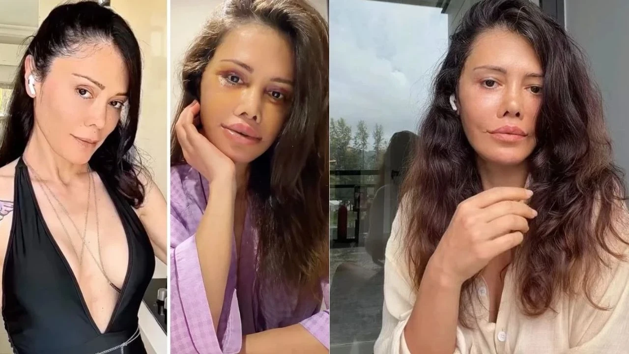Kore'de yüz nakli olan Didem Ceran isyan etti! "Cenazen ülkeye dönsün" dediler